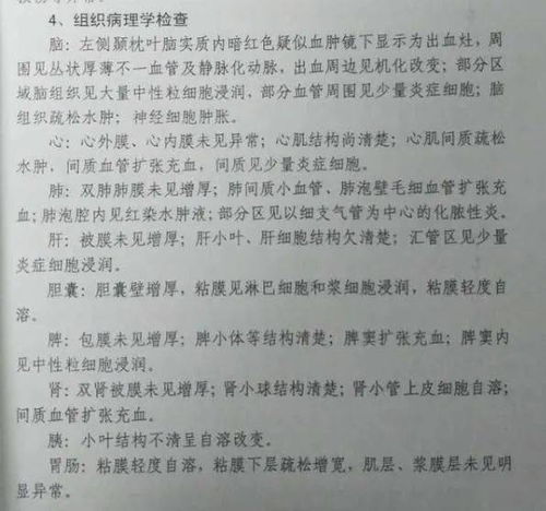 重大事件 17岁少年被拘看守所死亡 后脑袋全软的,家属质疑因死因,究竟怎么回事